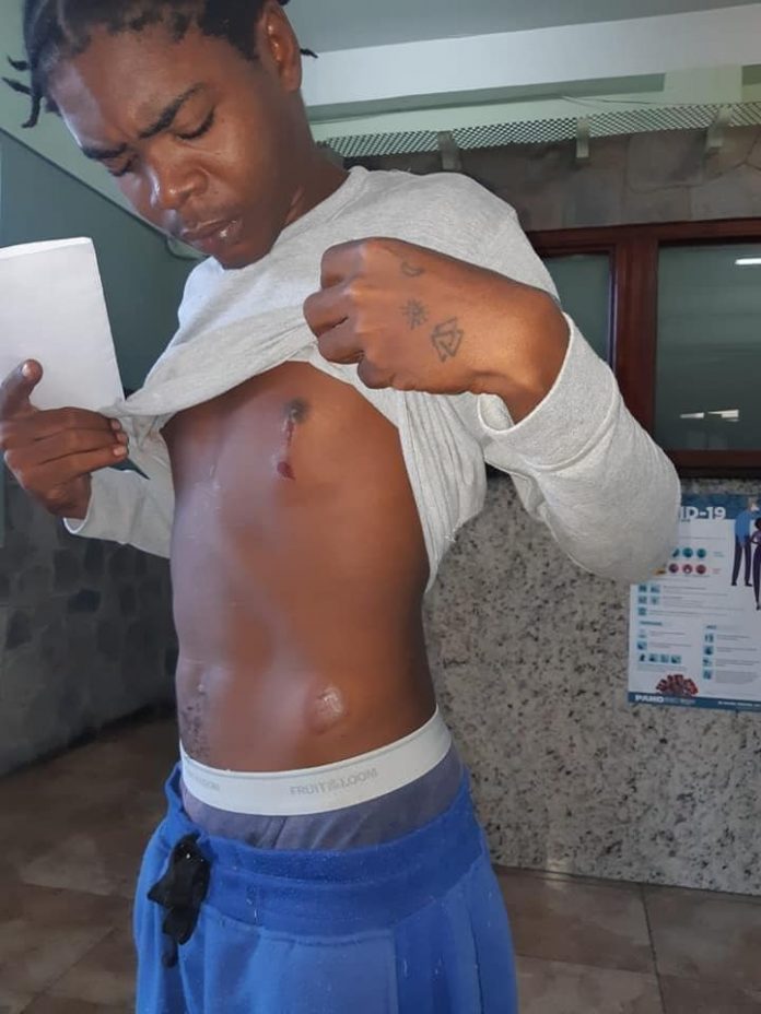 Youth beaten by the Police for violating the curfew