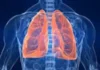 Jamaica Health Ministry Raises Alarm Over Rising Tuberculosis Cases in Detention Facilities
